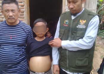 TPK Diutus Gubernur Sulsel Jemput Syahrul Bocah Penderita Jantung Bocor di Sinjai